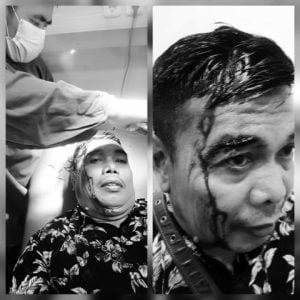 Bela Ferdy Sambo?, Polsek Ujung Pandang Tangguhkan Terduga Penganiayaan Tanpa Pernyataan Damai Korban