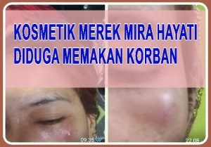 Kosmetik Mira Hayati Diduga Memakan Korban