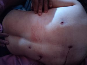 Polisi Berhasil Mengamankan Seorang Pria Terduga Pelaku Penembakan Di Kecamatan Pengkadan, Kabupaten Kapuas Hulu | NEWS TV Indonesia