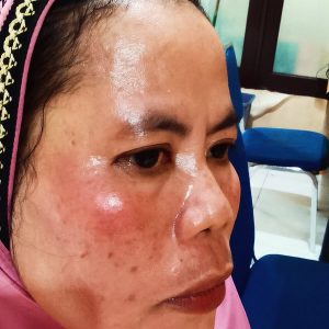 Hasil Visum Dokter Forensik RS Bhayangkara Diduga Rekayasa, Waduh Ada Apa!!!