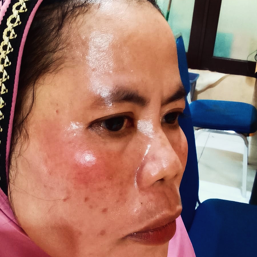 Hasil Visum Dokter Forensik RS Bhayangkara Diduga Rekayasa, Waduh Ada Apa!!! | NEWS TV Indonesia