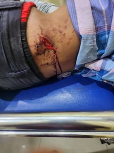 Polsek Makassar Tetapkan Tersangka Kasus Kekerasan Siswa SMAN 1 Makassar | NEWS TV Indonesia