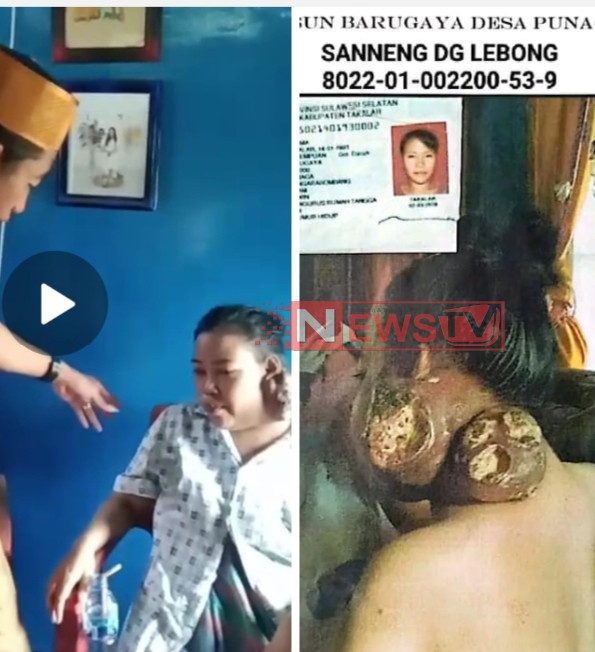 Halima, Warga Punaga yang Bertahun-Tahun Menderita Tumor Leher | NEWS TV Indonesia