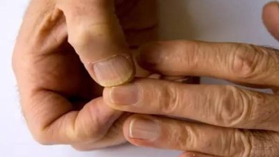 Penyakit Jantung: Kenali Gejalanya dan Penanganan Secara Herbalnya